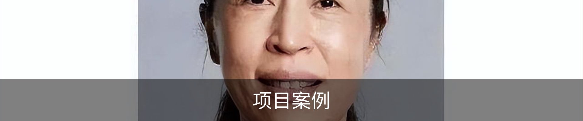 项目案例
